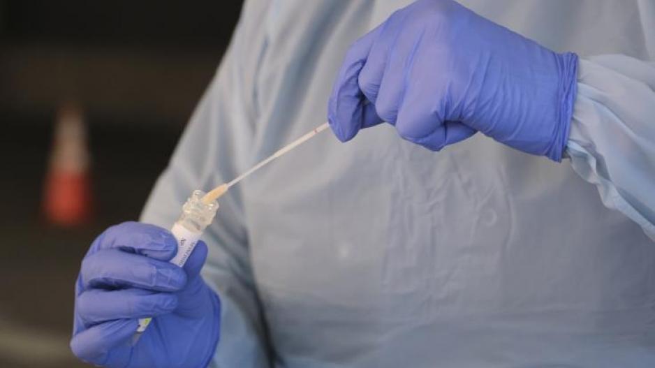 Κορωνοϊός: 20χρονος αλλοδαπός θετικός στον ιό μεταφέρθηκε στο ΝΙΜΤΣ από Δομή Φιλοξενίας